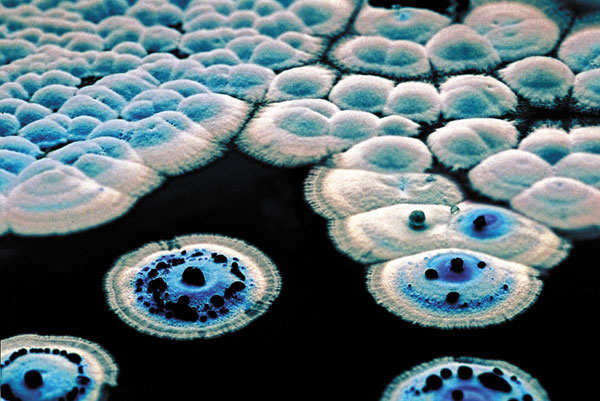 blue and white growths under magnification